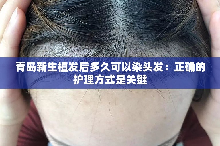 青岛新生植发后多久可以染头发：正确的护理方式是关键