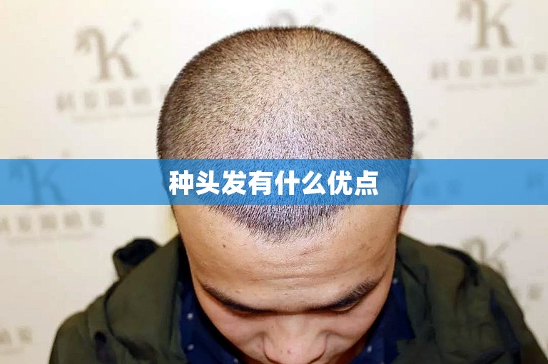 郑州比较好的植发专家怎么选