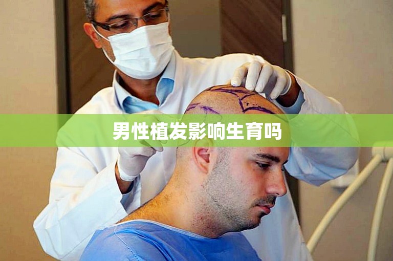 中国口碑好的植发医生选择攻略