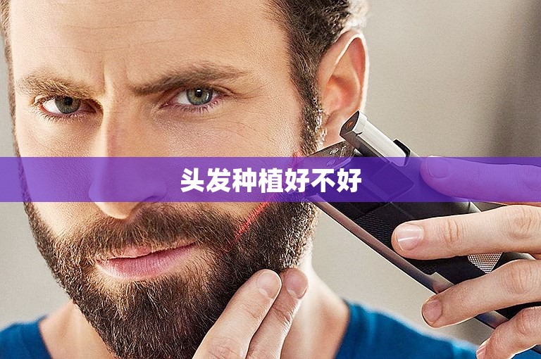 上海技术最好的植发医院怎么选