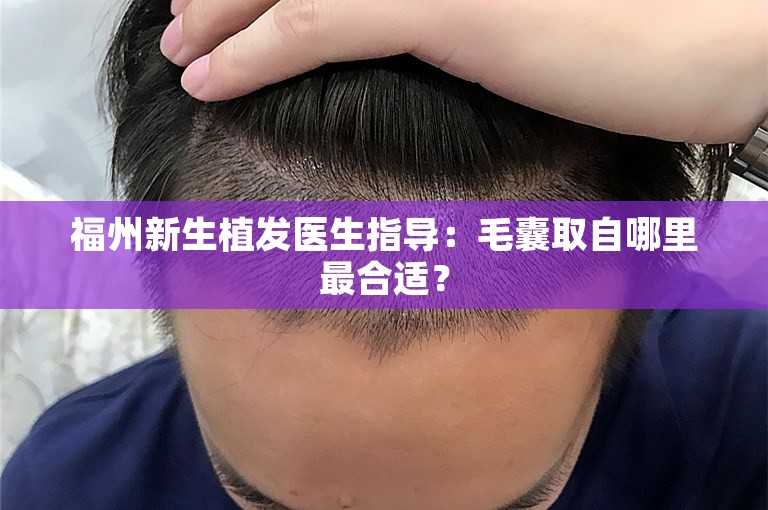 福州新生植发医生指导：毛囊取自哪里最合适？
