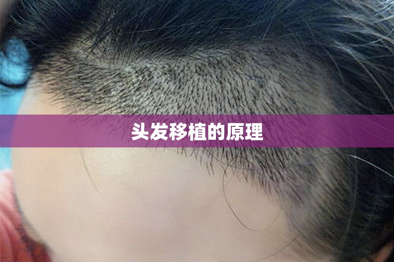 重庆最可靠的植发医院怎么选