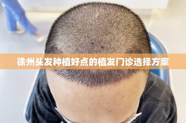 徐州头发种植好点的植发门诊选择方案