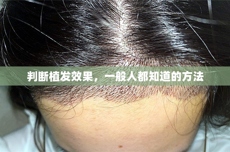 上海新生植发医院可靠吗？