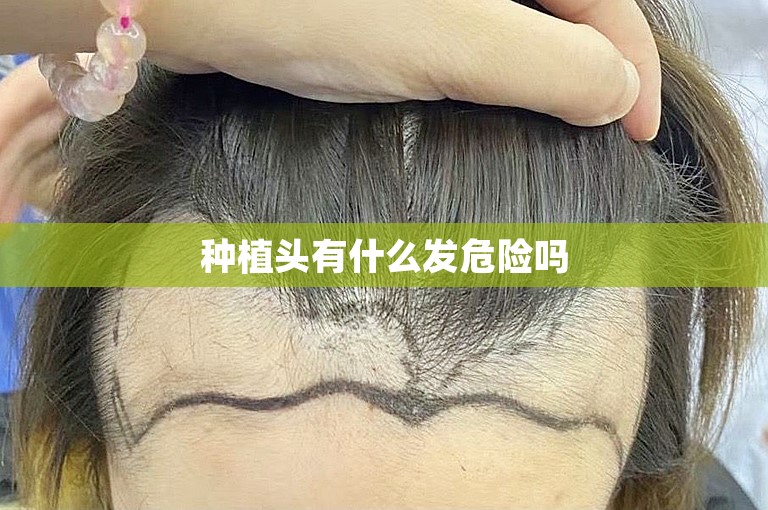 中国最可靠的植发门诊选择方案