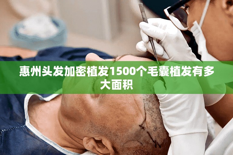 惠州头发加密植发1500个毛囊植发有多大面积
