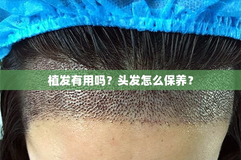 上海公认最好的植发门诊选择攻略