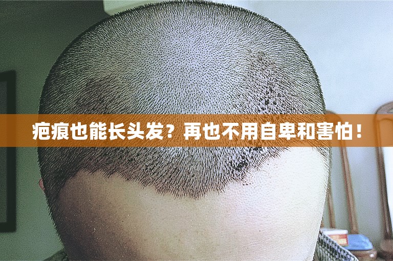 中国公认最好的植发医院选择方案