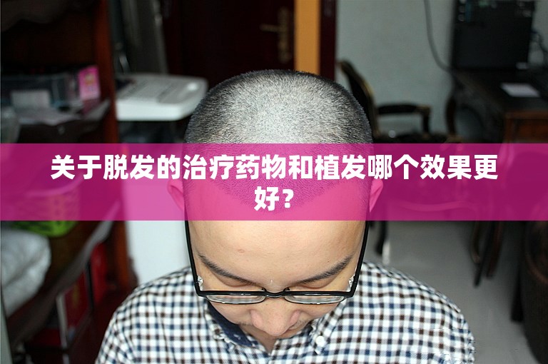 中国头发种植好点的植发专家怎么选