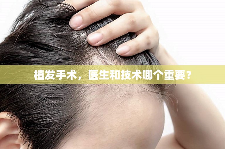 外国人如何选择好的植发门诊在大庆