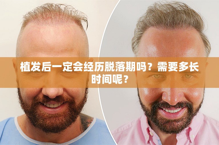 天津知名的植发门诊选择方案
