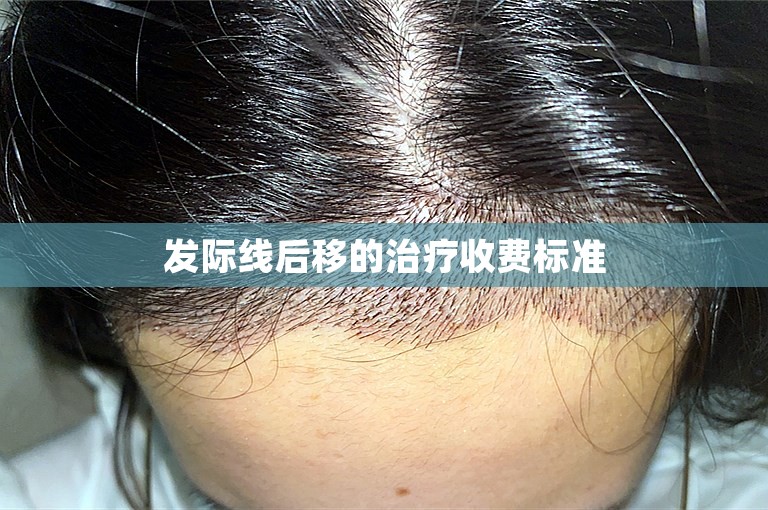 北京公认最好的植发门诊选择方案