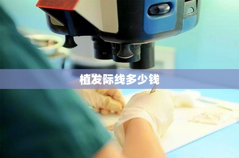 广州技术好的植发机构选择方案