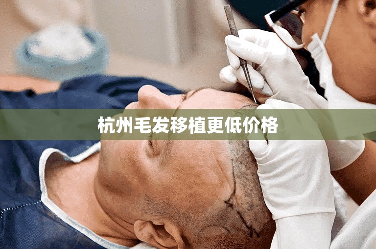 徐州最可靠的植发专家怎么选