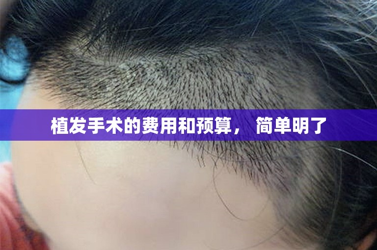 北京公认最好的植发门诊选择攻略