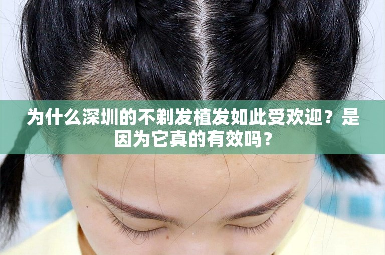 为什么深圳的不剃发植发如此受欢迎？是因为它真的有效吗？