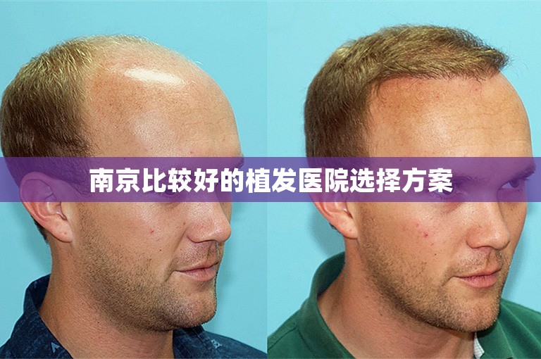 南京比较好的植发医院选择方案