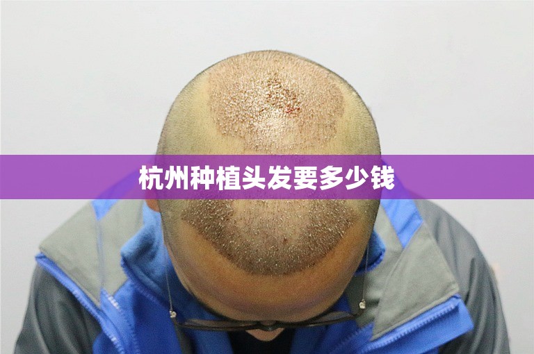 上海新生植发医院靠谱吗？