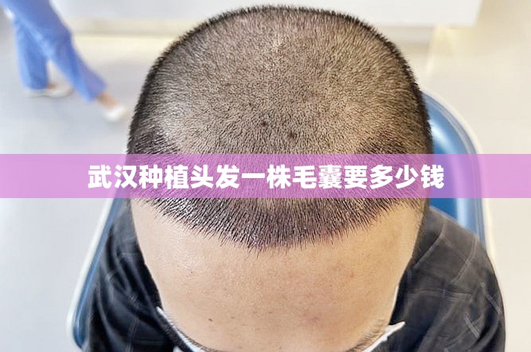 中国最安全的植发医生选择攻略