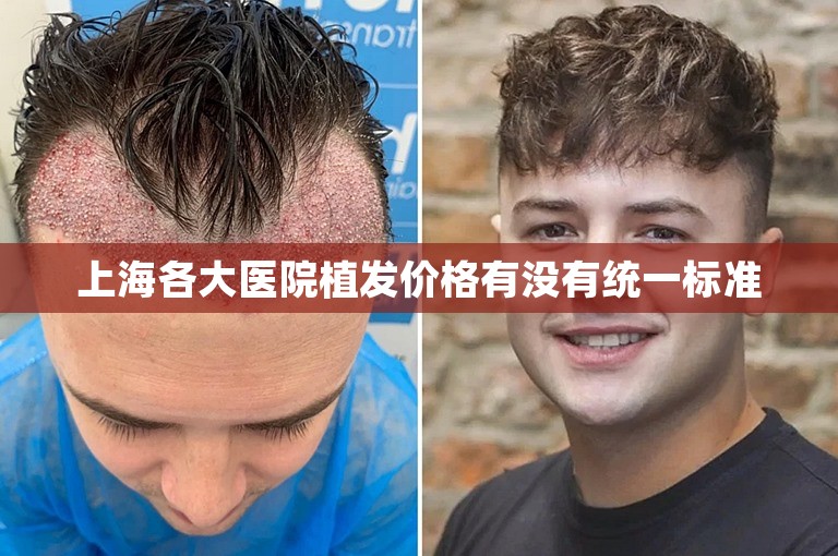 南京知名的植发门诊怎么选