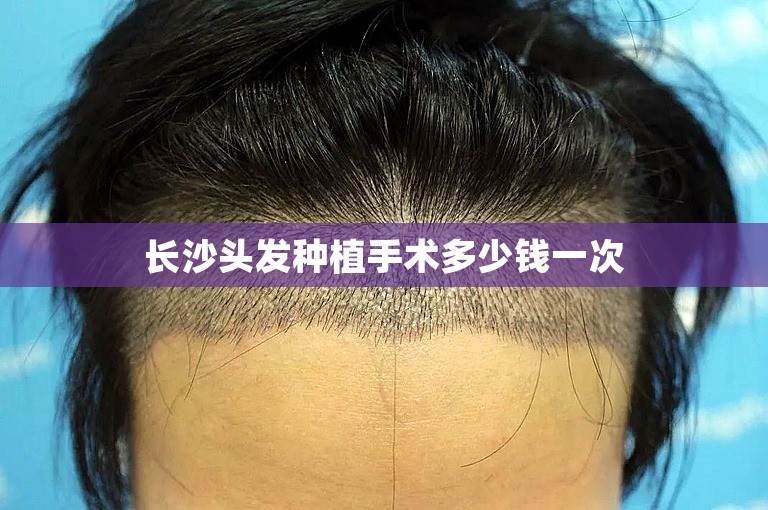 乌鲁木齐头发种植好点的植发医生选择方案