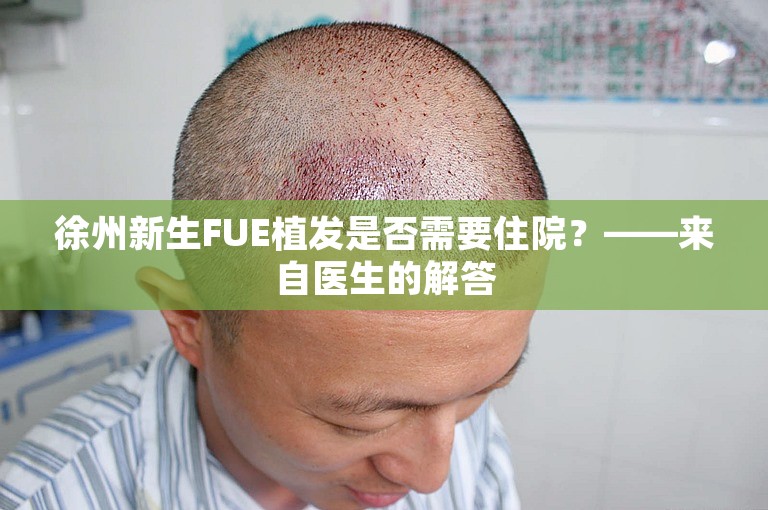 徐州新生FUE植发是否需要住院？——来自医生的解答