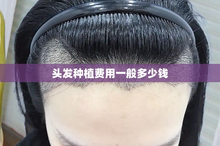 台州最安全的植发门诊怎么选