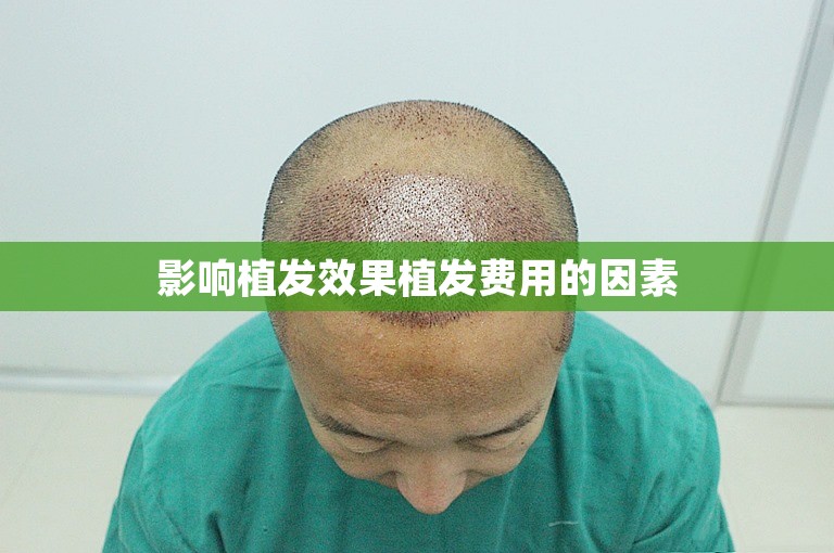 徐州最权威的植发医生怎么选