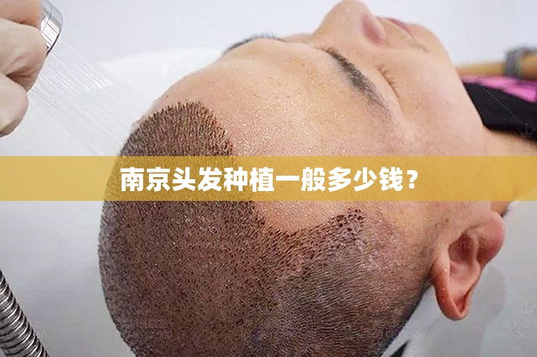 南京头发种植一般多少钱？