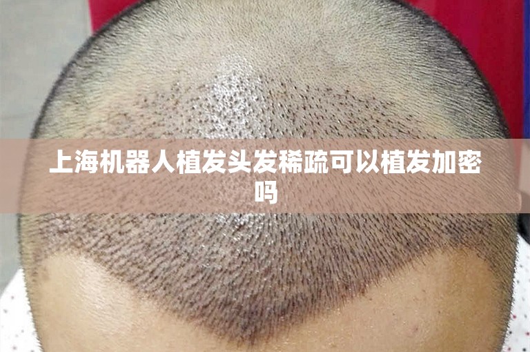 上海机器人植发头发稀疏可以植发加密吗