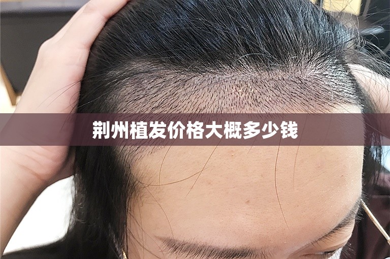 南京最可靠的植发医生选择方案