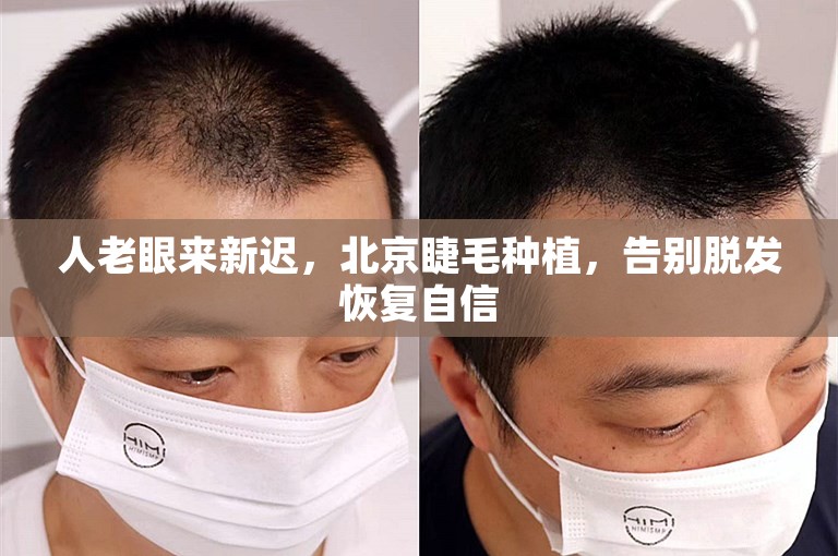 人老眼来新迟，北京睫毛种植，告别脱发恢复自信
