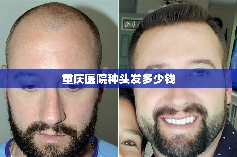 广州知名的植发门诊选择方案