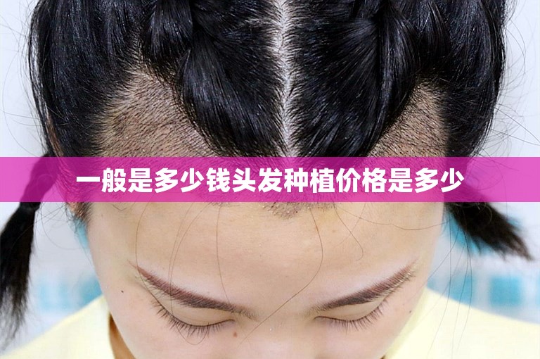 郑州头发种植好点的植发医院选择方案