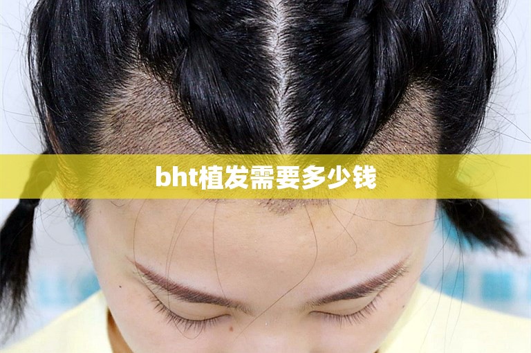 bht植发需要多少钱