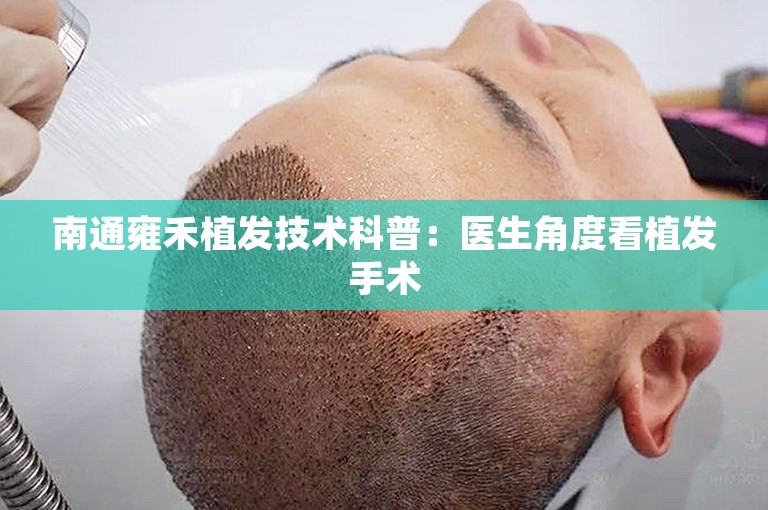 南通雍禾植发技术科普：医生角度看植发手术