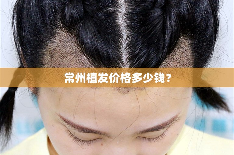 杭州公认最好的植发专家怎么选