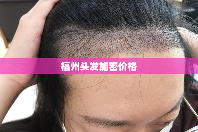 南京头发种植好点的植发门诊选择攻略