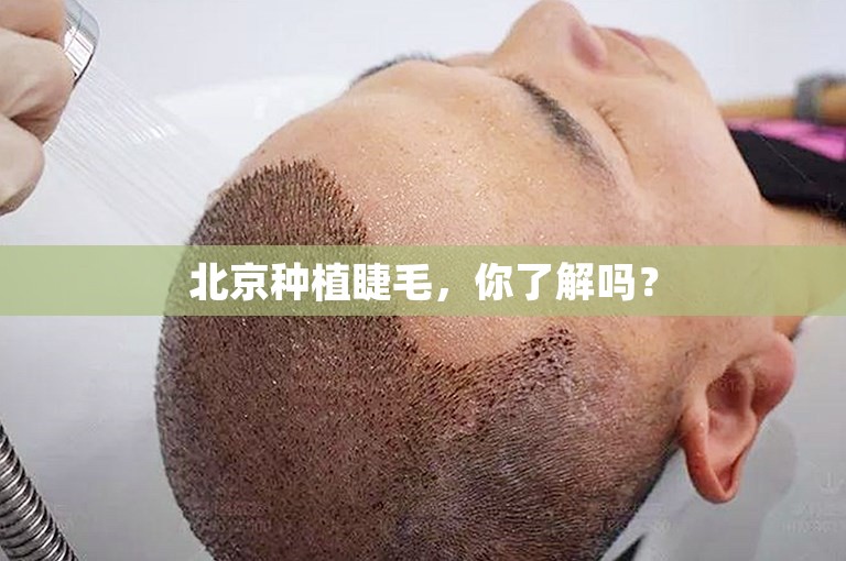 北京种植睫毛，你了解吗？
