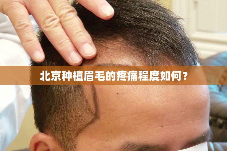 北京种植眉毛的疼痛程度如何？