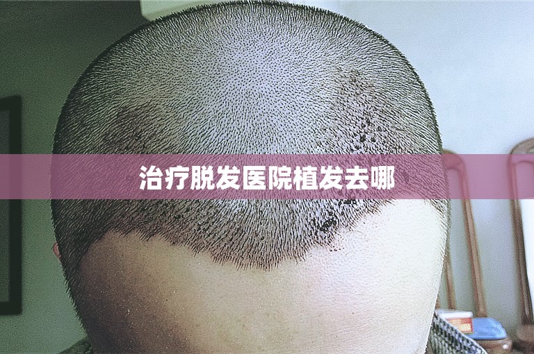 郑州最可靠的植发门诊怎么选