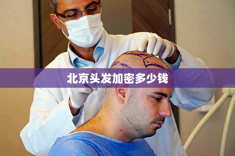 北京公认最好的植发门诊怎么选