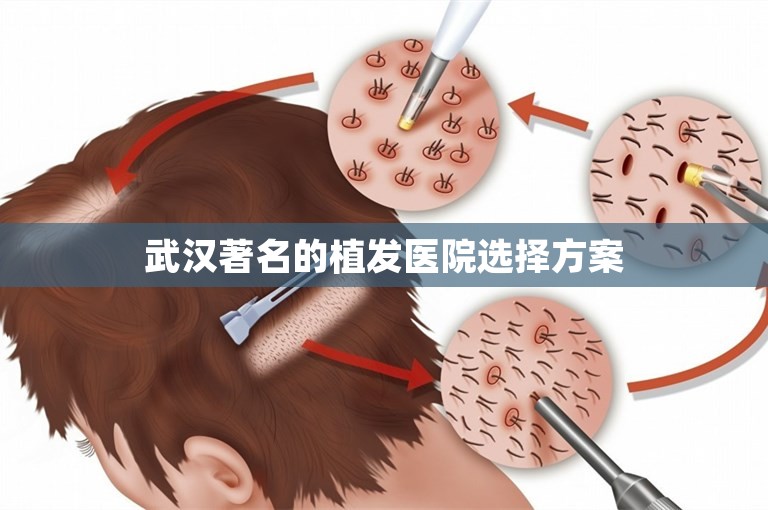 武汉著名的植发医院选择方案