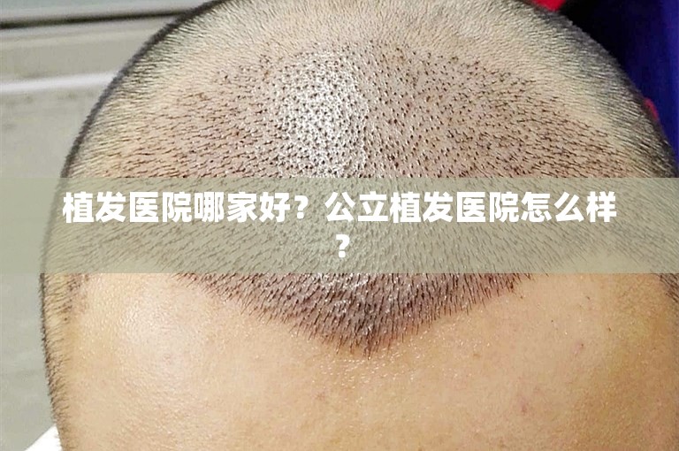 上海新生植发医院技术好不好？