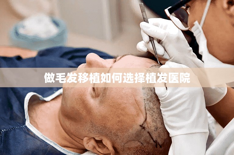 青岛公立植发医院哪家最好？