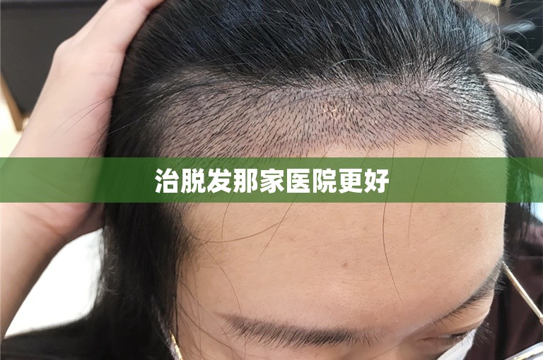 合肥头发种植好点的植发机构选择攻略