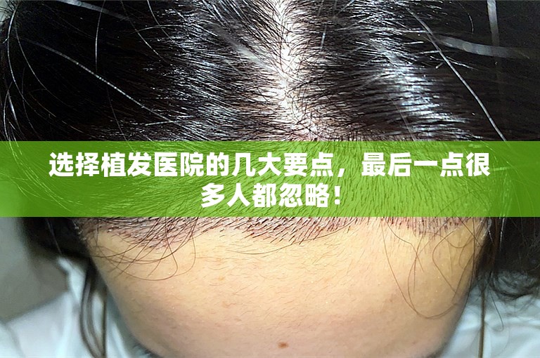 重庆最权威的植发医院选择方案