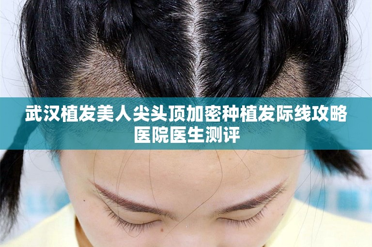 北京最可靠的植发医生选择攻略