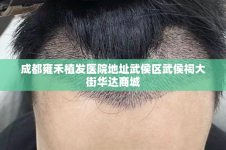西安最可靠的植发门诊选择方案