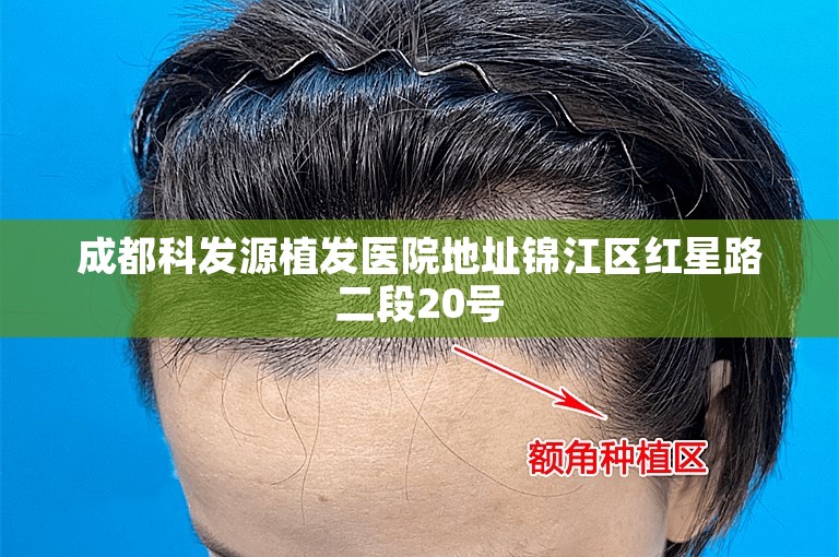 惠州知名的植发医生选择方案